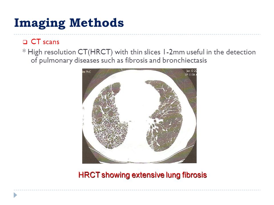  CT scans * High resolution CT(HRCT) with thin slices 1-2mm useful in the detection of pulmonary diseases such as fibrosis and bronchiectasis HRCT showing extensive lung fibrosis Imaging Methods
