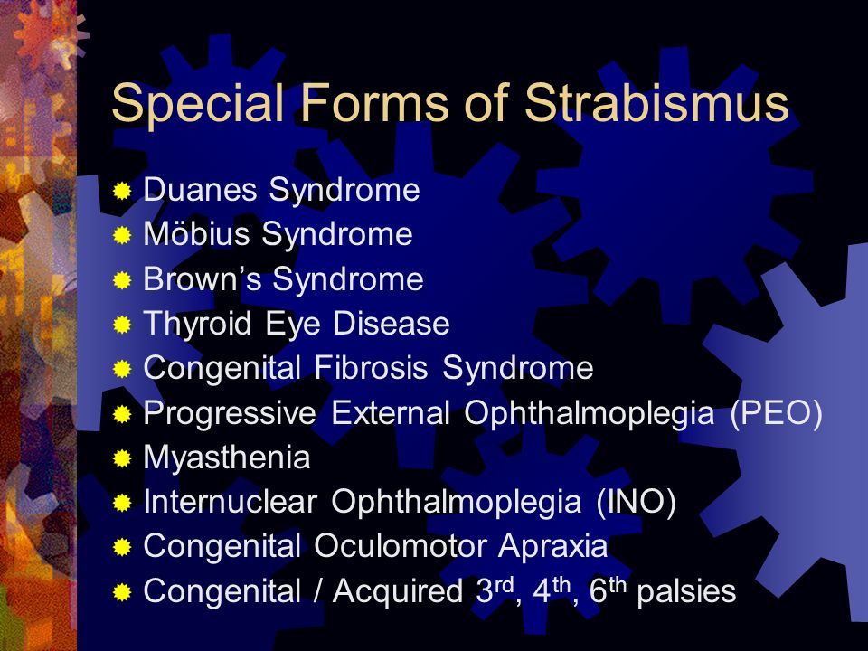 A And V Patterns And Other Types Of Strabismus Paviglianiti