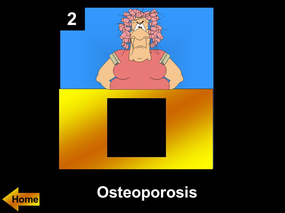 2 Osteoporosis