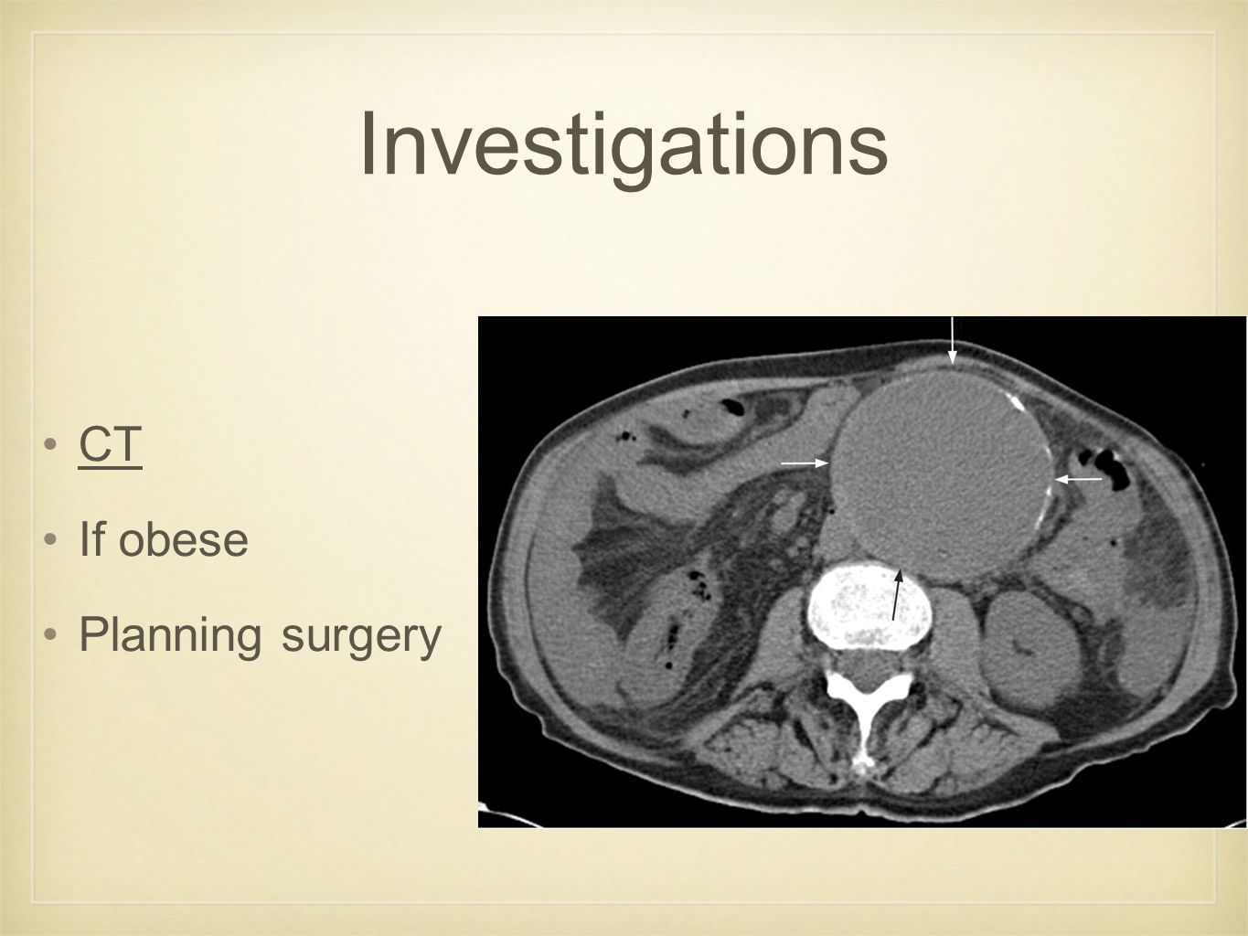 Investigations CT If obese Planning surgery