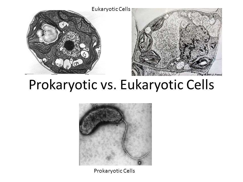 Prokaryotic vs. Eukaryotic Cells Eukaryotic Cells Prokaryotic Cells