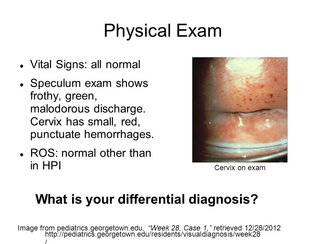 vaginal burning and discharge Vaginal burning and discharge