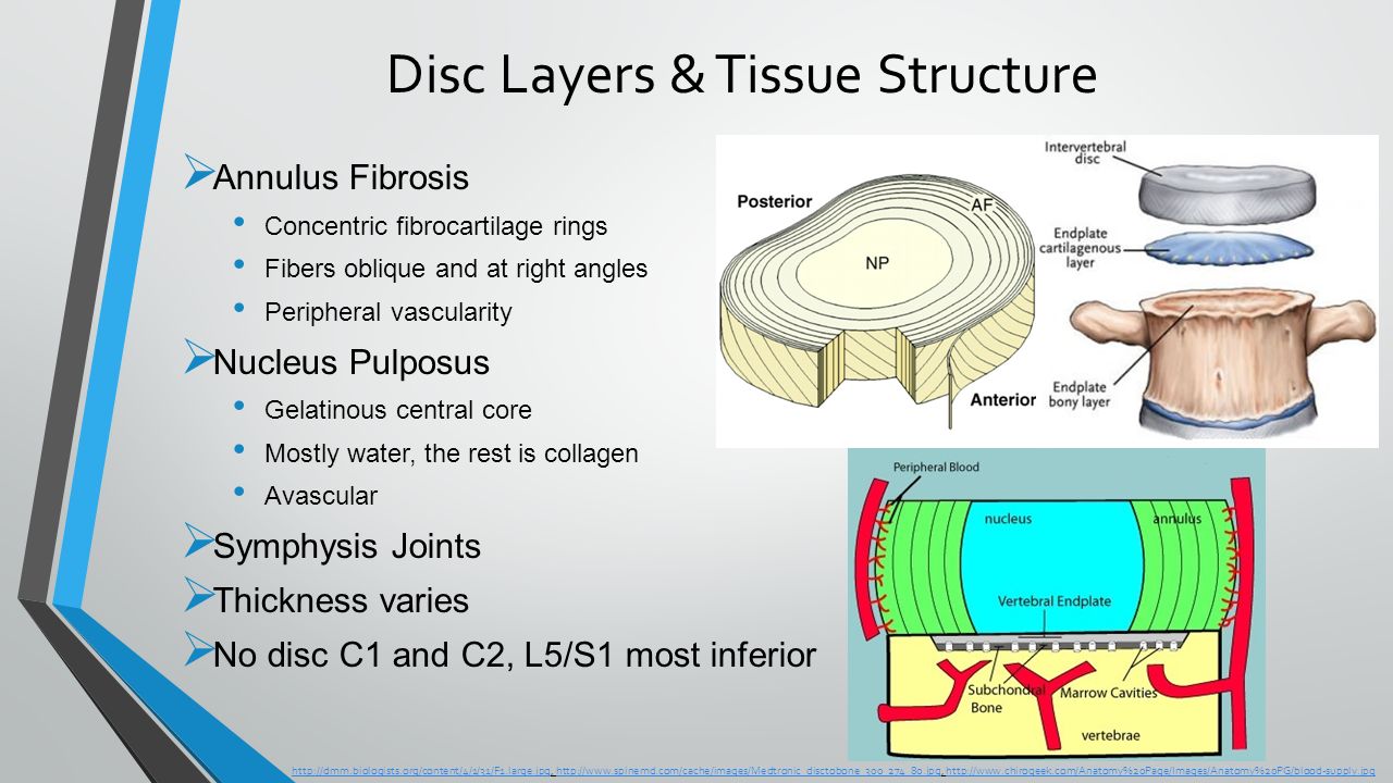 Disc Layers & Tissue Structure  Annulus Fibrosis Concentric fibrocartilage rings Fibers oblique and at right angles Peripheral vascularity  Nucleus Pulposus Gelatinous central core Mostly water, the rest is collagen Avascular  Symphysis Joints  Thickness varies  No disc C1 and C2, L5/S1 most inferior
