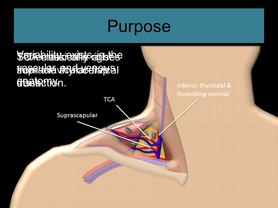 supraclavicular lymph nodes diagram