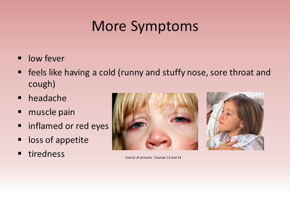 Rubella By Lena Zadruzynski Anatomy Physiology 6 Th Hour Mr Weidert Ppt Download