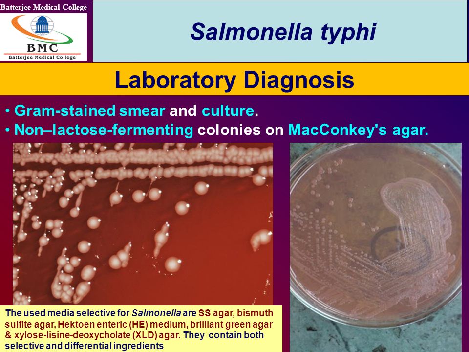 pix Salmonella Enterica Gram Stain batterjee medical college dr manal el