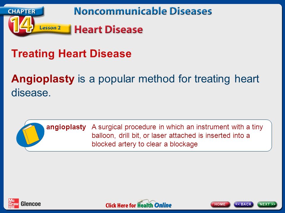 Treating Heart Disease Angioplasty is a popular method for treating heart disease.
