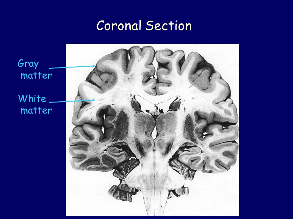 Introduction to Cortical Neurons