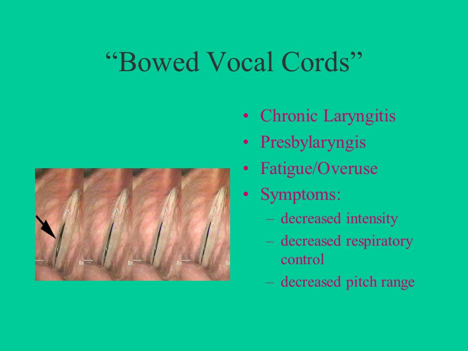 Peter R. LaPine, Ph.D. Department of Audiology and Speech Sciences Michigan  State University. - ppt download