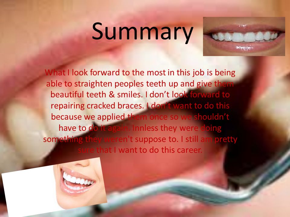 Summary What I look forward to the most in this job is being able to straighten peoples teeth up and give them beautiful teeth & smiles.