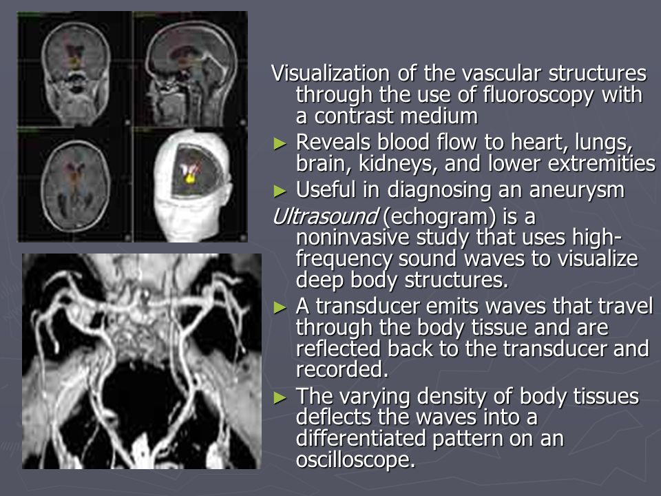 Visualization of the vascular structures through the use of fluoroscopy with a contrast medium ► Reveals blood flow to heart, lungs, brain, kidneys, and lower extremities ► Useful in diagnosing an aneurysm Ultrasound (echogram) is a noninvasive study that uses high- frequency sound waves to visualize deep body structures.