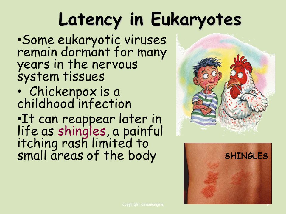 9 Latency in Eukaryotes Some eukaryotic viruses remain dormant for many years in the nervous system tissues Chickenpox is a childhood infection It can reappear later in life as shingles, a painful itching rash limited to small areas of the body SHINGLES copyright cmassengale