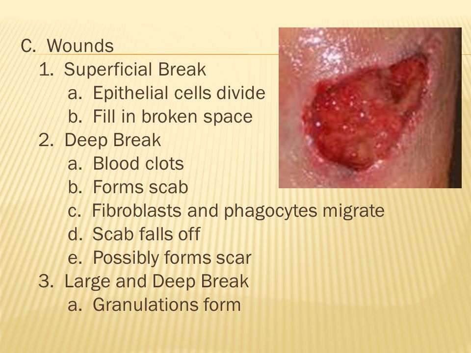 C. Wounds 1. Superficial Break a. Epithelial cells divide b.