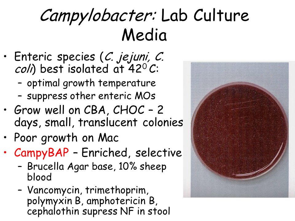 CampylobacteriaceaeCampylobacteriaceae Campylobacter Heliobacter  Heliobacter (Gram-negative curved rods) - ppt download