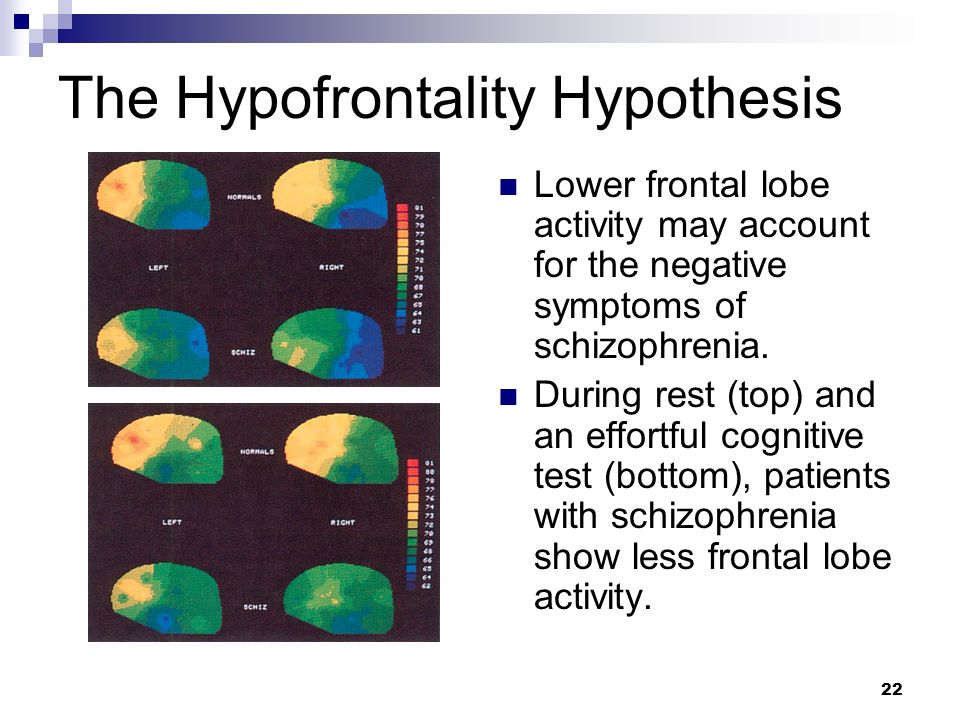 1 Chapter 16 Schizophrenia Ppt Download