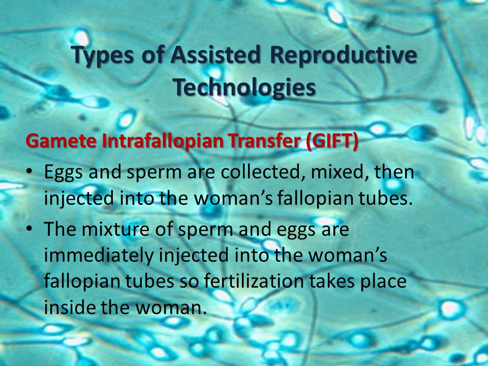 ICSI Key Findings  Assisted Reproductive Technology ART  CDC