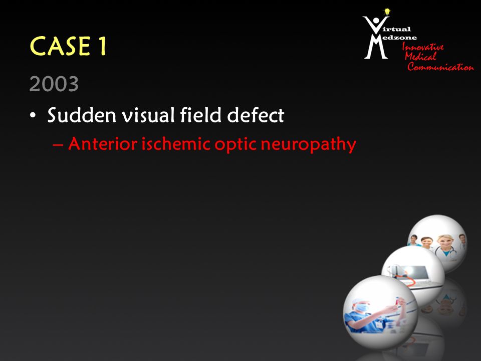 CASE Sudden visual field defect – Anterior ischemic optic neuropathy