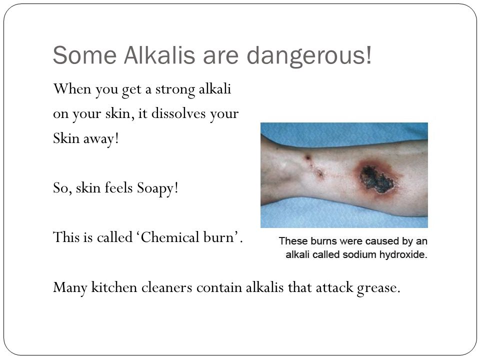 Some Alkalis are dangerous. When you get a strong alkali on your skin, it dissolves your Skin away.