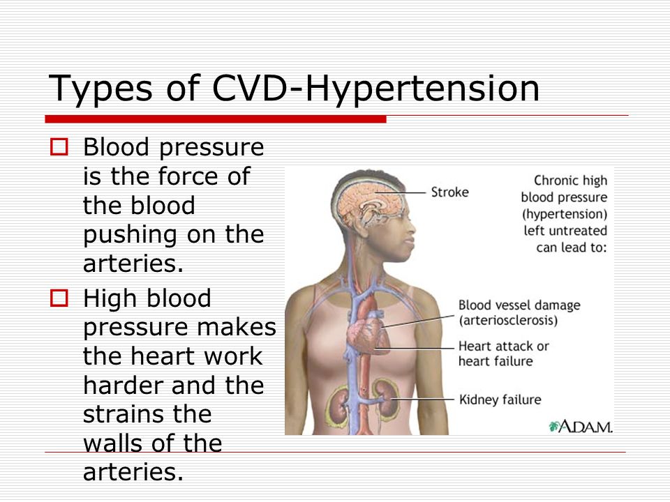 Types of CVD-Hypertension  Blood pressure is the force of the blood pushing on the arteries.