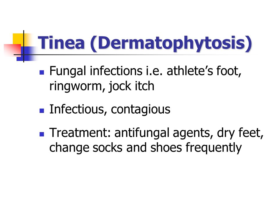 Tinea (Dermatophytosis) Fungal infections i.e.
