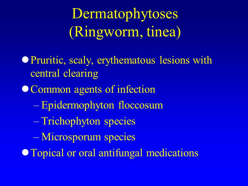 Tinea Versicolor Vs Tinea Nigra 