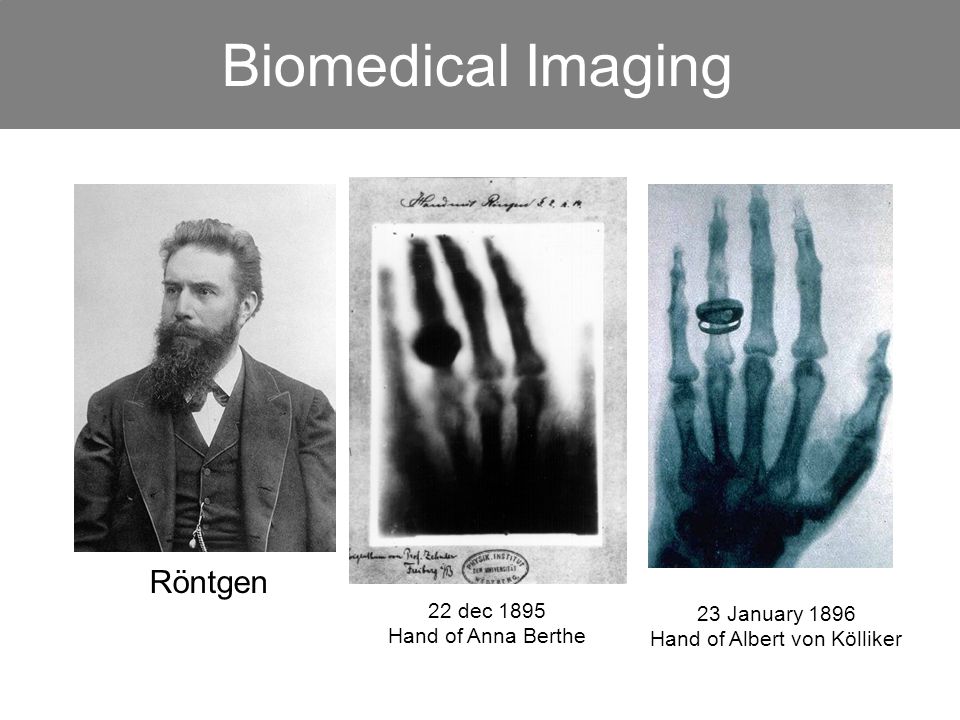 Biomedical applications of molecular imaging Tony Lahoutte UMons Nov-Dec ppt download