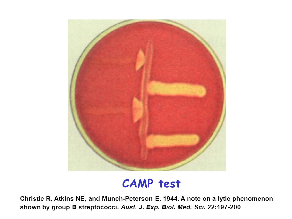 CAMP test Christie R, Atkins NE, and Munch-Peterson E.