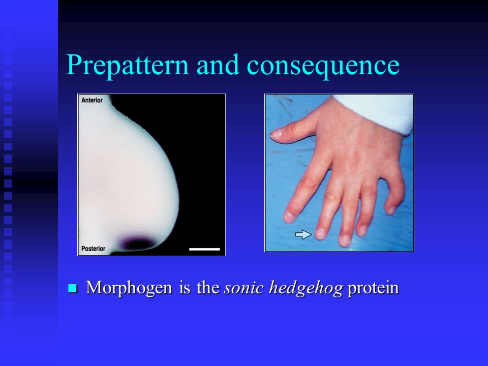 Prepattern and consequence Morphogen is the sonic hedgehog protein
