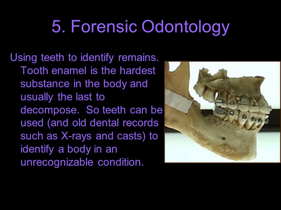 5. Forensic Odontology Using teeth to identify remains.