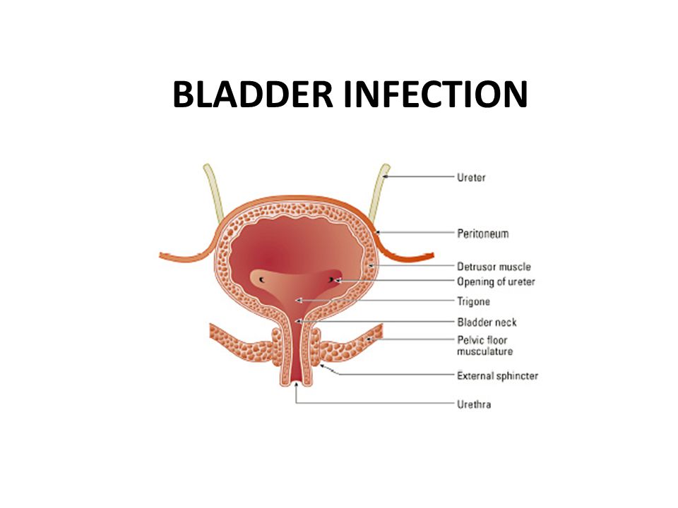 cystitis and sex Cystitis and sex