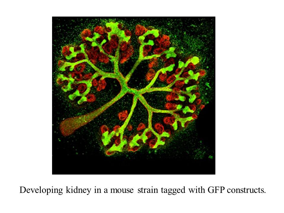 Developing kidney in a mouse strain tagged with GFP constructs.