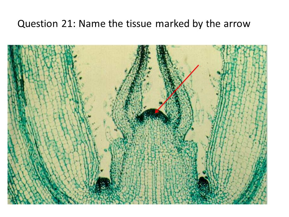 Question 21: Name the tissue marked by the arrow