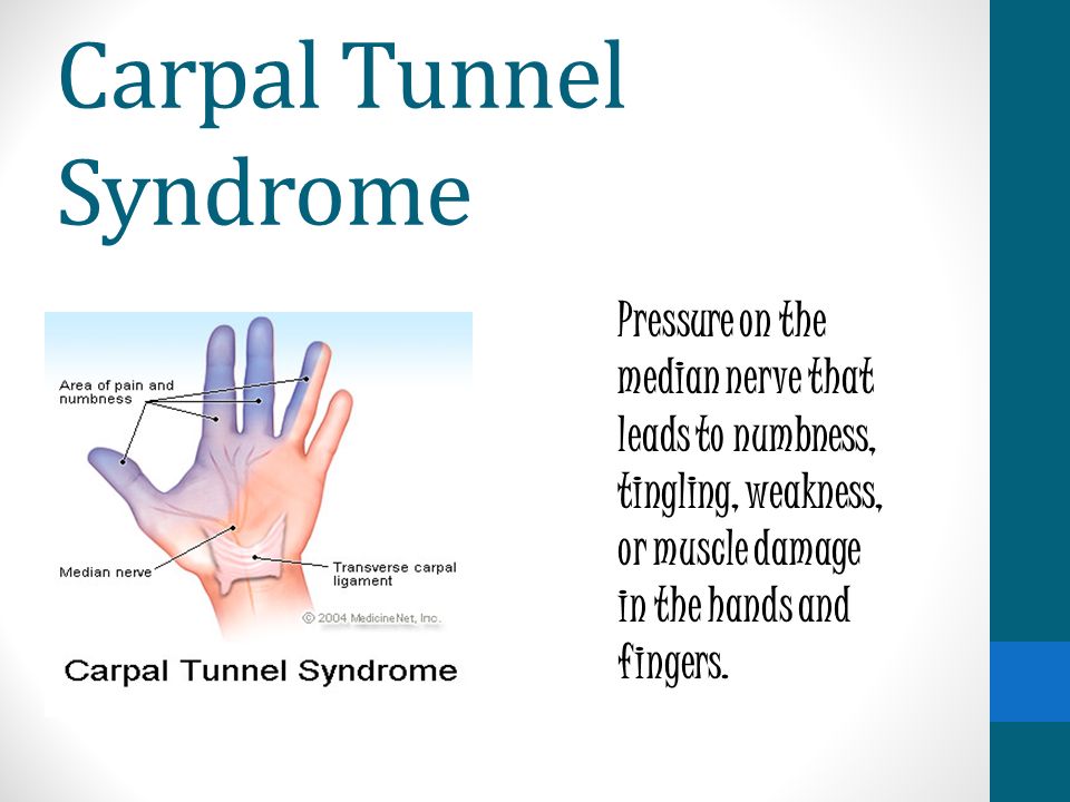 Carpal Tunnel Syndrome Pressure on the median nerve that leads to numbness, tingling, weakness, or muscle damage in the hands and fingers.