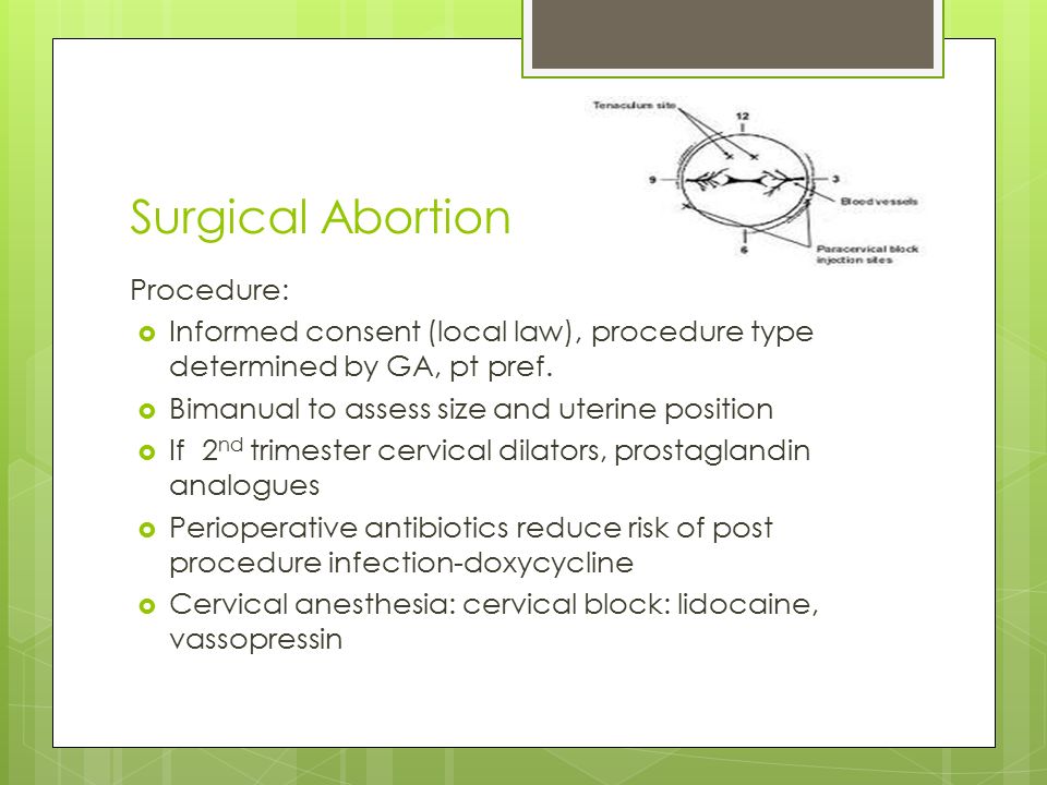 Surgical Abortion Procedure:  Informed consent (local law), procedure type determined by GA, pt pref.