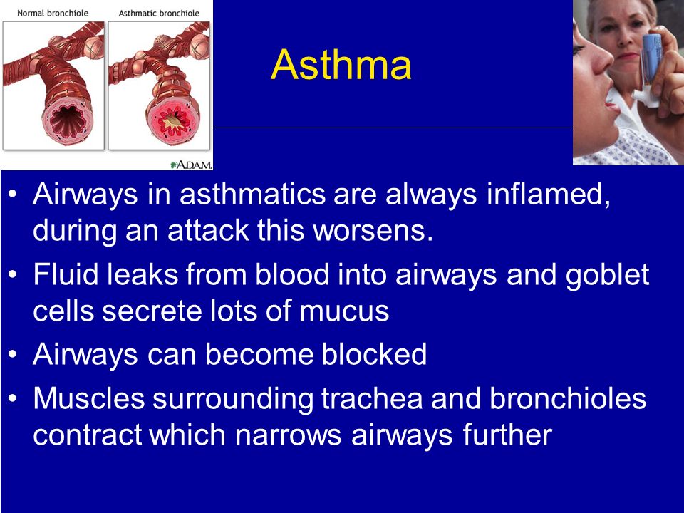 Asthma Airways in asthmatics are always inflamed, during an attack this worsens.