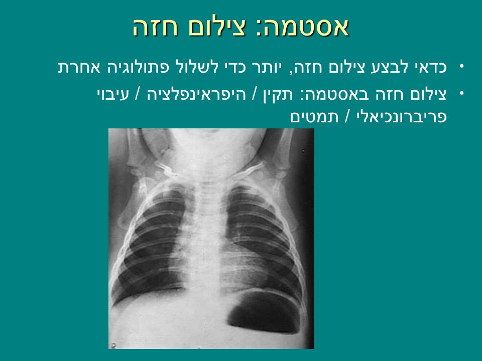 Asthma in childhood E. Picard M.D. Pediatric Pulmonary Unit Shaare Zedek  Medical Center Jerusalem. - ppt download