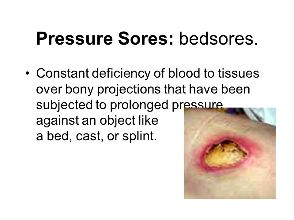 Pressure Sores: bedsores.