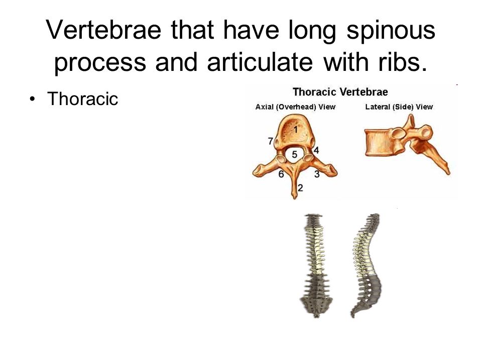 Vertebrae that have long spinous process and articulate with ribs. Thoracic