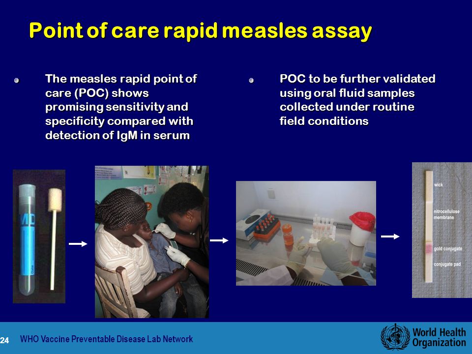 24 Point of care rapid measles assay The measles rapid point of care (POC) shows promising sensitivity and specificity compared with detection of IgM in serum WHO Vaccine Preventable Disease Lab Network 24 POC to be further validated using oral fluid samples collected under routine field conditions