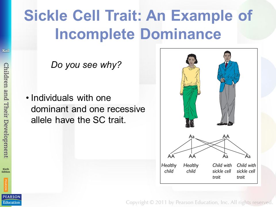 Sickle Cell Trait: An Example of Incomplete Dominance Do you see why.