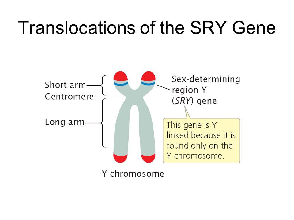 Translocations of the SRY Gene