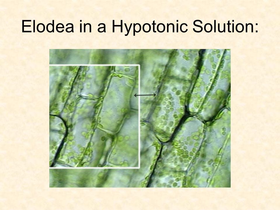 Особенности внутреннего строения элодеи. Клетки листа элодеи канадской. Клетки листа элодеи под микроскопом. Хлоропласты в листе элодеи. Клетка элодеи канадской.