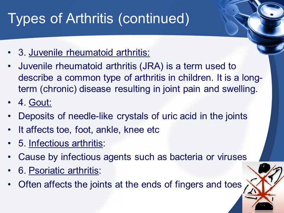 Types of Arthritis (continued) 3.