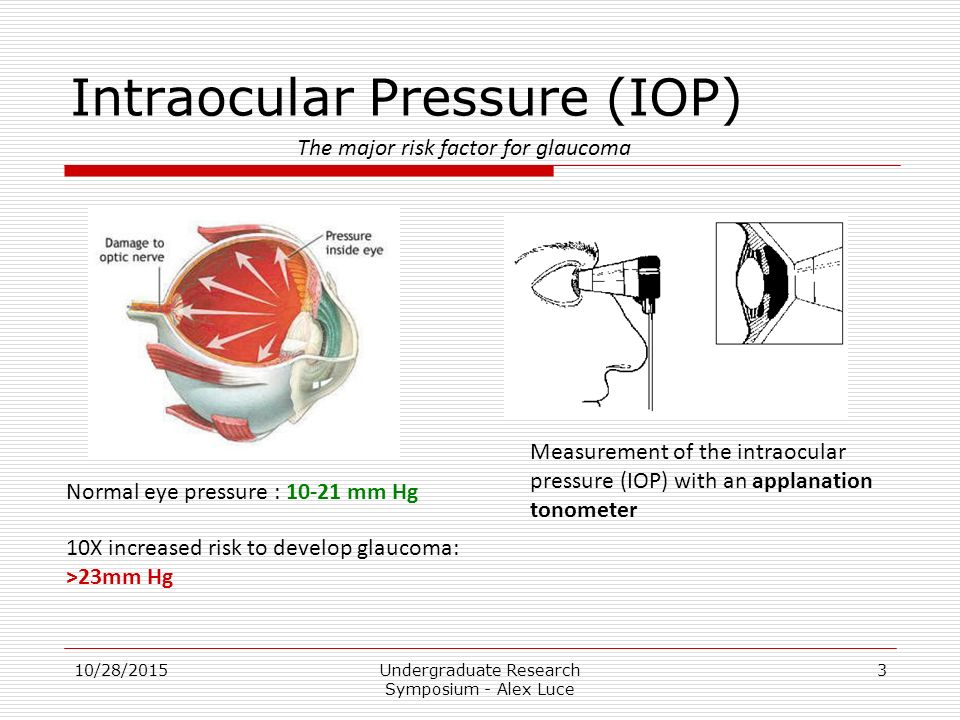 In-vitro measurement of Intra- Ocular Pressure Alex Luce