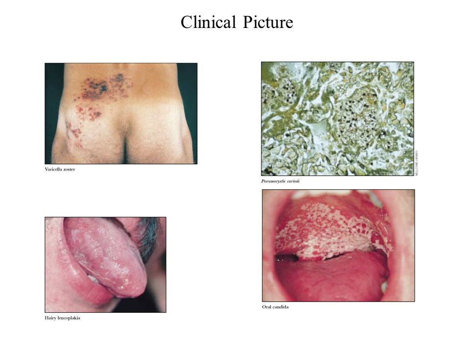 Clinical Picture