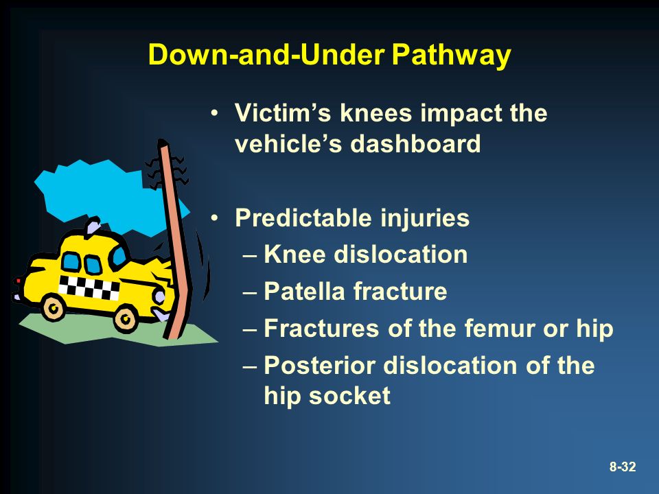 8-32 Down-and-Under Pathway Victim’s knees impact the vehicle’s dashboard Predictable injuries –Knee dislocation –Patella fracture –Fractures of the femur or hip –Posterior dislocation of the hip socket