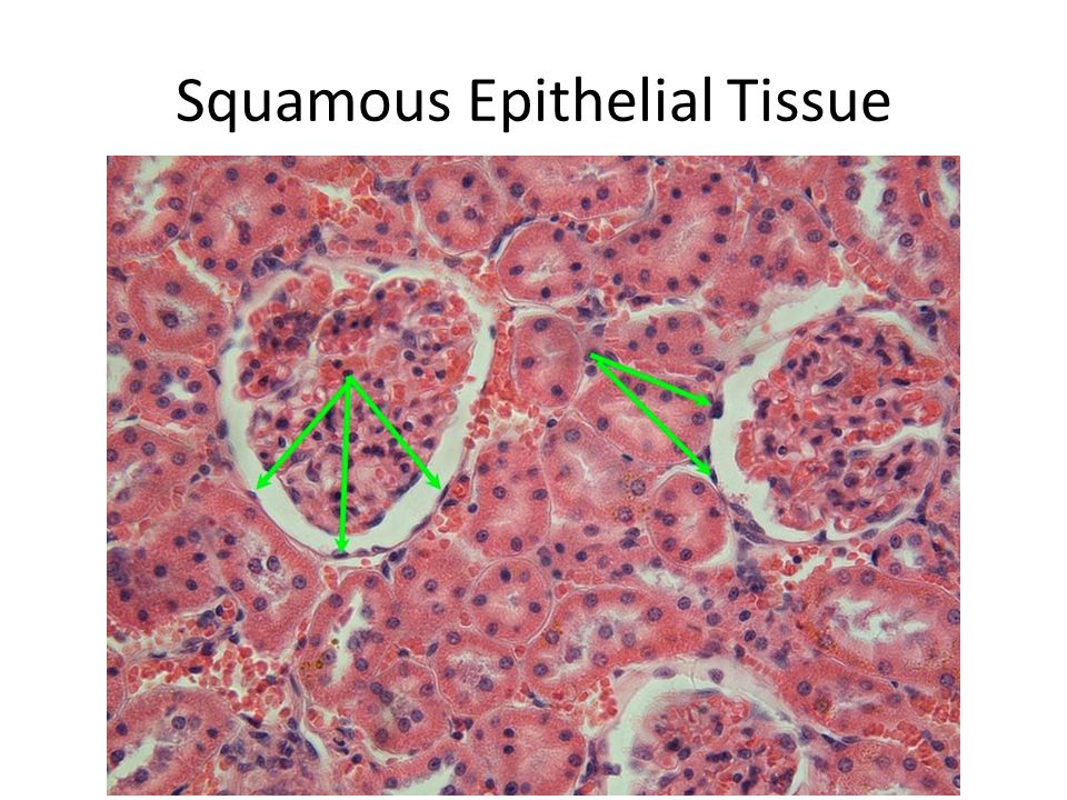 Squamous Epithelial Tissue