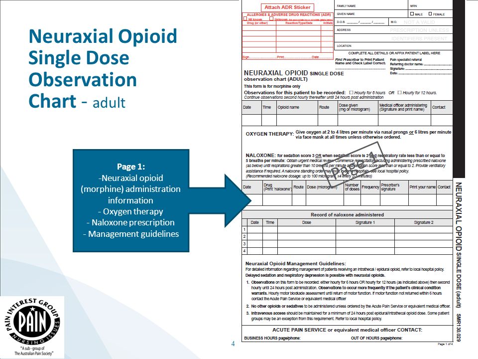 neuraxial opioid single dose observation chart adult education hospital observation chart