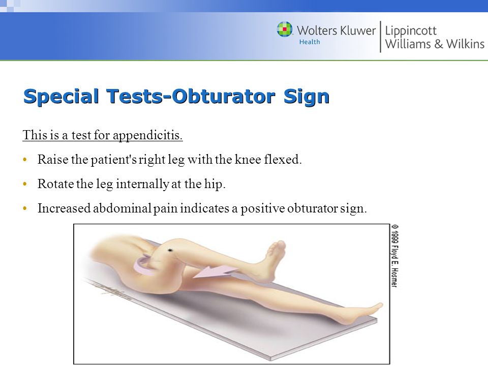 abdomen tests for appendicitis abdomen tests for appendicitis