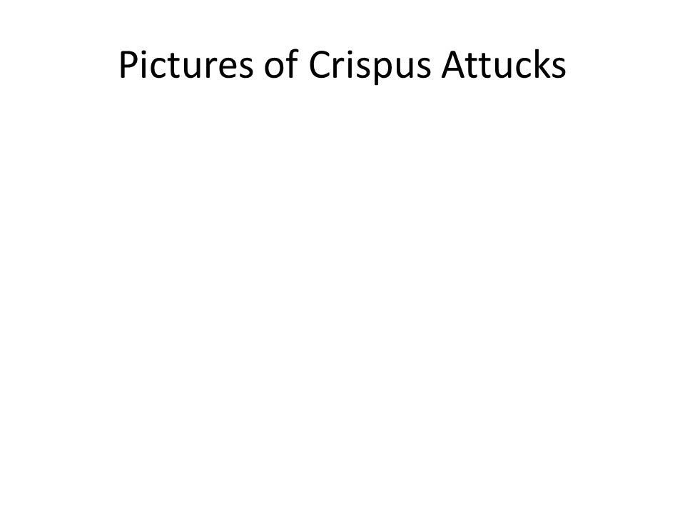Pictures of Crispus Attucks